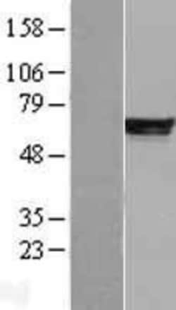 Novus Biologicals&trade;&nbsp;PDE4B Overexpression Lysate