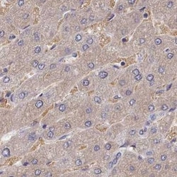 PDE4C Antibody, Novus Biologicals:Antibodies:Primary Antibodies