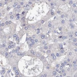 PDE4C Antibody, Novus Biologicals:Antibodies:Primary Antibodies