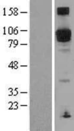 Novus Biologicals&trade;&nbsp;PDE5A Overexpression Lysate