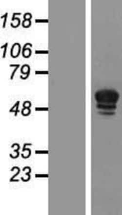 Novus Biologicals PDE5A Overexpression Lysate 0.1 mg | Buy Online | Novus Biologicals&trade; | Fisher Scientific