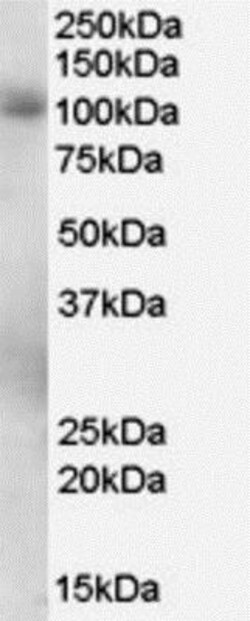 PDE5A Antibody, Novus Biologicals 0.1mg; Unlabeled:Antibodies, Polyclonal