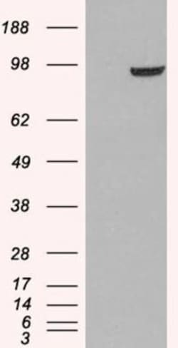 PDE5A Antibody, Novus Biologicals 0.1mg; Unlabeled:Antibodies, Polyclonal