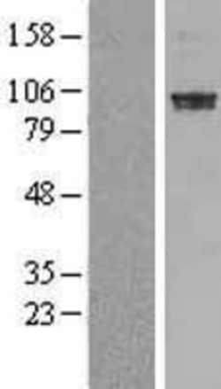 Novus Biologicals&trade;&nbsp;PDE6A Overexpression Lysate