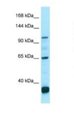 PDE6C Antibody, Novus Biologicals 100&mu;L; Unlabeled:Antibodies, Polyclonal