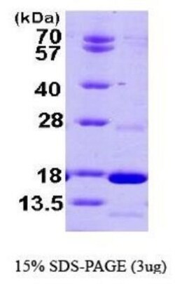 Novus Biologicals&trade;&nbsp;Recombinant Human PDE6D His Protein