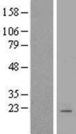 Novus Biologicals&trade;&nbsp;PDE6G Overexpression Lysate