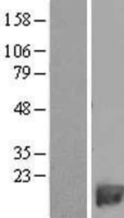 Novus Biologicals&trade;&nbsp;PDE6H Overexpression Lysate