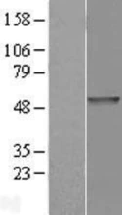 Novus Biologicals&trade;&nbsp;PDE7B Overexpression Lysate