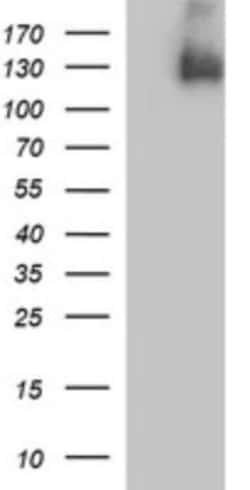 PDGF R beta Antibody (OTI1E8), Novus Biologicals 0.1mL; Unlabeled:Antibodies,
