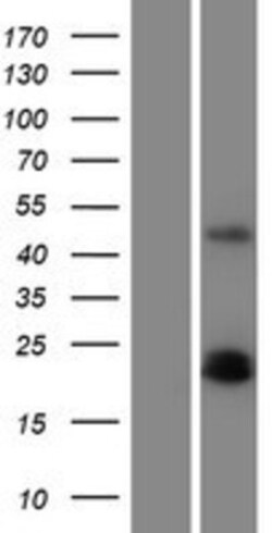 Novus Biologicals&trade;&nbsp;PDGFA Overexpression Lysate