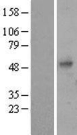 Novus Biologicals&trade;&nbsp;PDGF-B Overexpression Lysate