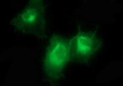 PDGF R beta Antibody (OTI1E8), Novus Biologicals 0.1mL; Unlabeled:Antibodies,