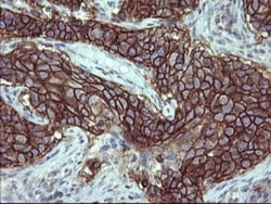 PDGF R beta Antibody (OTI1E8), Novus Biologicals 0.1mL; Unlabeled:Antibodies,