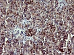 PDGF R beta Antibody (OTI1E8), Novus Biologicals 0.1mL; Unlabeled:Antibodies,