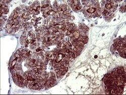 PDGF R beta Antibody (OTI1E8), Novus Biologicals 0.1mL; Unlabeled:Antibodies,