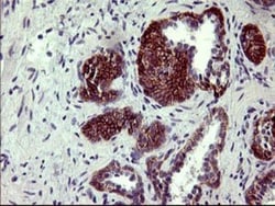 PDGF R beta Antibody (OTI1E8), Novus Biologicals 0.1mL; Unlabeled:Antibodies,