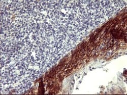 PDGF R beta Antibody (OTI1E8), Novus Biologicals 0.1mL; Unlabeled:Antibodies,