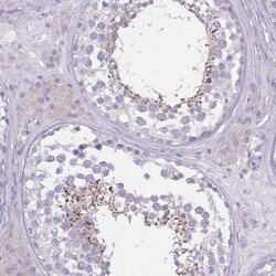 PDHA2 Antibody, Novus Biologicals:Antibodies:Primary Antibodies