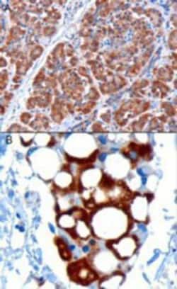 PDHX Antibody, Novus Biologicals 0.1mg; Unlabeled:Antibodies, Polyclonal