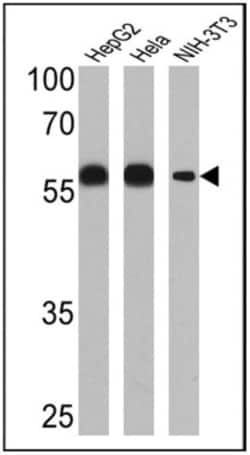 Protein Disulfide Isomerase/P4HB Antibody (RL77), Novus Biologicals 0.1mL;