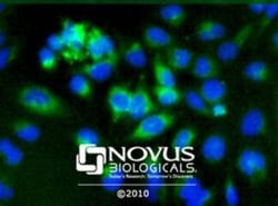 PDIA2 Antibody, Novus Biologicals 0.025mL; Unlabeled:Antibodies, Polyclonal