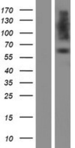 Novus Biologicals&trade;&nbsp;PDIA2 Overexpression Lysate