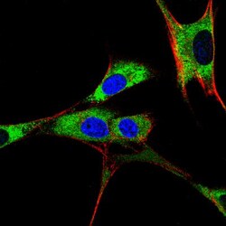PDIA2 Antibody, Novus Biologicals 0.025mL; Unlabeled:Antibodies, Polyclonal