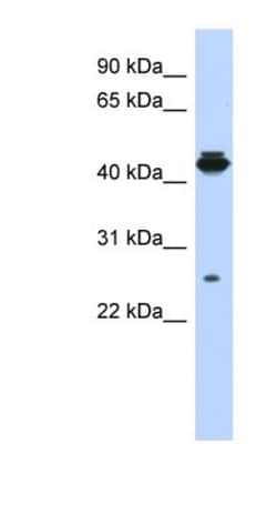 PDIK1L Antibody, Novus Biologicals 100&mu;L; Unlabeled:Antibodies, Polyclonal