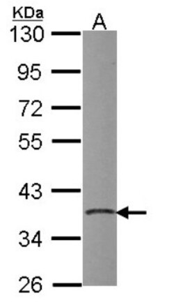 PDIK1L Antibody, Novus Biologicals 0.1mL; Unlabeled:Antibodies, Polyclonal