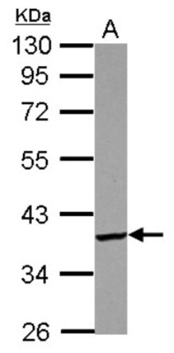 PDIK1L Antibody, Novus Biologicals 0.1mL; Unlabeled:Antibodies, Polyclonal