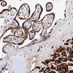 PDIR Antibody, Novus Biologicals 0.1mL; Unlabeled:Antibodies, Polyclonal