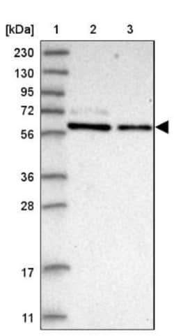 PDIR Antibody, Novus Biologicals 0.1mL; Unlabeled:Antibodies, Polyclonal