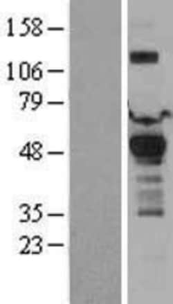 Novus Biologicals&trade;&nbsp;Pyruvate Dehydrogenase Kinase 1/PDK1 Overexpression Lysate