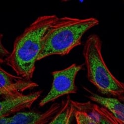 Pyruvate Dehydrogenase Kinase 1/PDK1 Antibody (4A11), Novus Biologicals