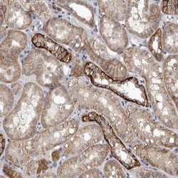 Pyruvate Dehydrogenase Kinase 1/PDK1 Antibody, Novus Biologicals:Antibodies:Primary