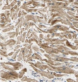 PDK2 Antibody, Novus Biologicals 0.1mL; Unlabeled:Antibodies, Polyclonal