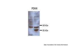PDK4 Antibody, Novus Biologicals 0.05mg; Unlabeled:Antibodies, Polyclonal