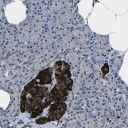 PDLIM1 Antibody, Novus Biologicals 0.1mL; Unlabeled:Antibodies, Polyclonal
