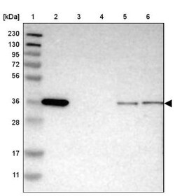PDLIM1 Antibody, Novus Biologicals 0.1mL; Unlabeled:Antibodies, Polyclonal