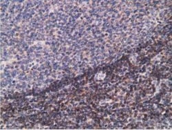 PDLIM2 Antibody (OTI11A12), Novus Biologicals 0.1mL; Unlabeled:Antibodies,