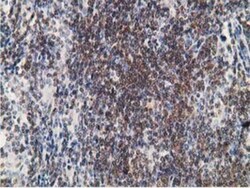 PDLIM2 Antibody (OTI11A12), Novus Biologicals 0.1mL; Unlabeled:Antibodies,