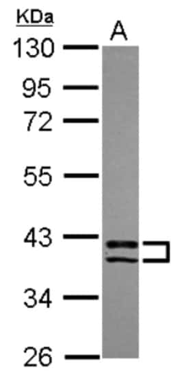 PDLIM2 Antibody, Novus Biologicals 0.1mL; Unlabeled:Antibodies, Polyclonal