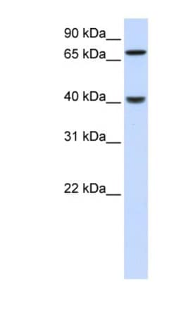 PDLIM3 Antibody, Novus Biologicals 100&mu;L; Unlabeled:Antibodies, Polyclonal