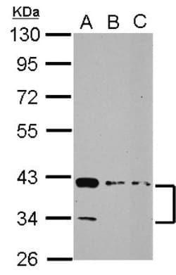 PDLIM3 Antibody, Novus Biologicals 0.1mL; Unlabeled:Antibodies, Polyclonal