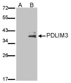 PDLIM3 Antibody, Novus Biologicals 0.1mL; Unlabeled:Antibodies, Polyclonal