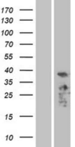 Novus Biologicals&trade;&nbsp;PDLIM3 Overexpression Lysate
