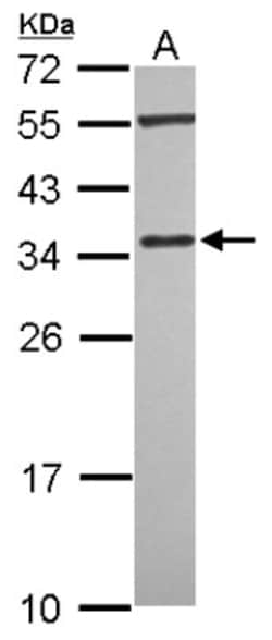 PDLIM4 Antibody, Novus Biologicals 0.1mL; Unlabeled:Antibodies, Polyclonal