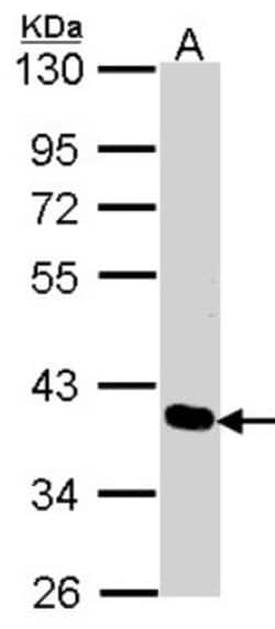 PDLIM4 Antibody, Novus Biologicals 0.1 mL | Buy Online | Novus Biologicals | Fisher Scientific