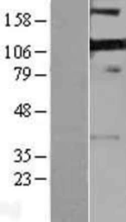 Novus Biologicals&trade;&nbsp;PDLIM4 Overexpression Lysate